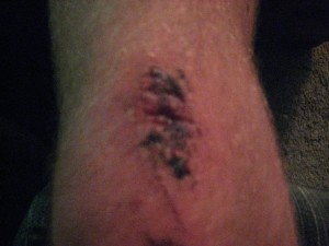Nice Knee